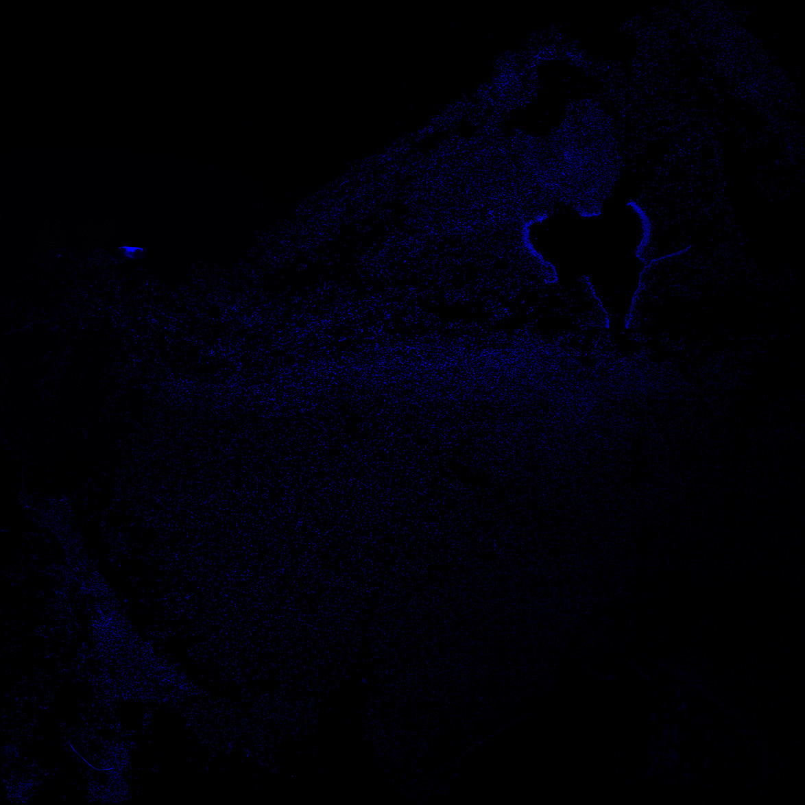 Human foetal midbrain